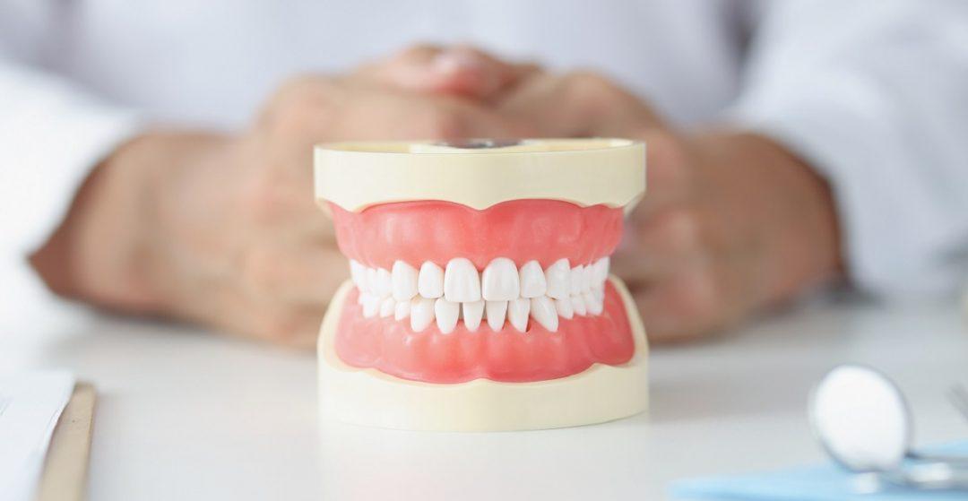 Partial Dentures Vs. Fixed Implant Bridges: Which One to Consider?
