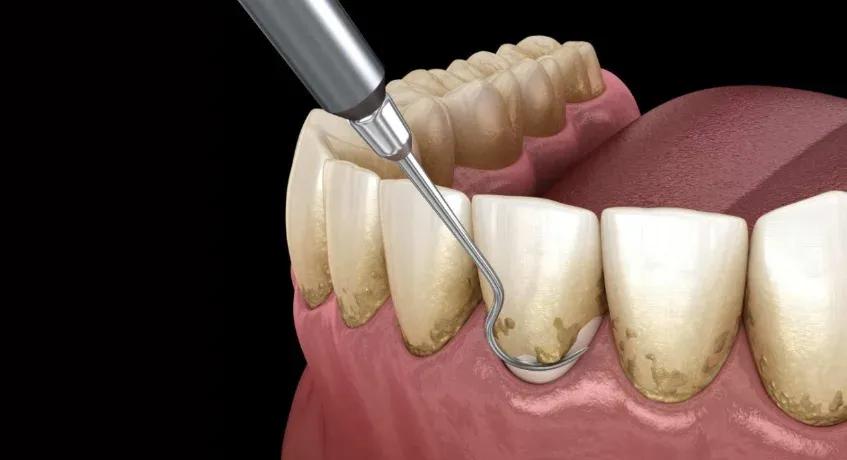 restorative dentistry options