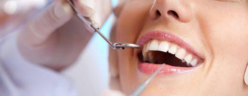 When do you Need Teeth Deep Cleaning?