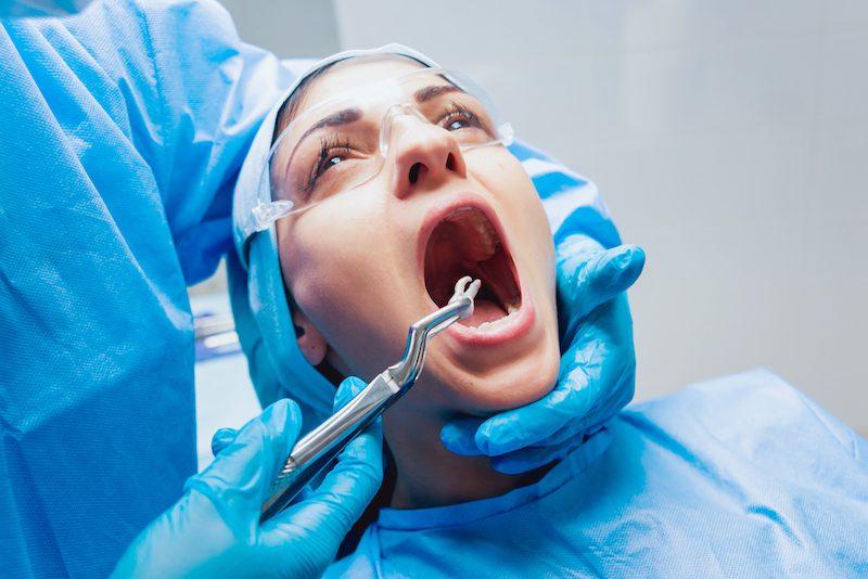 Teeth Extraction: Is it Preventable?