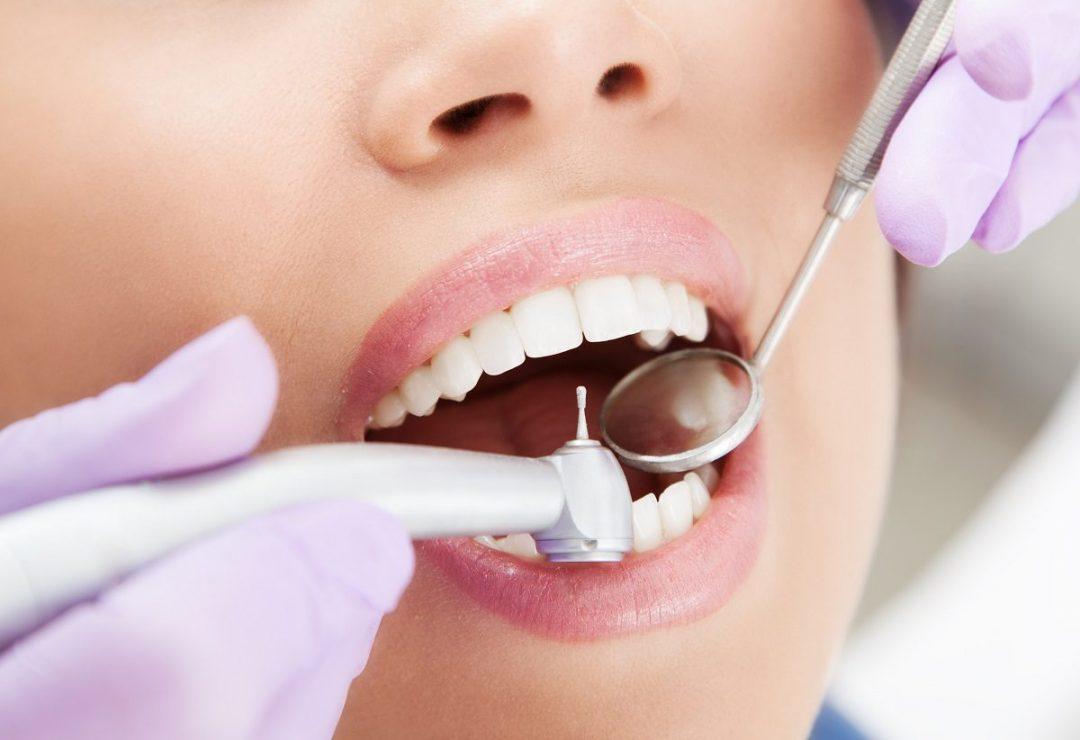 Who Should Get Root Canal Treatment?