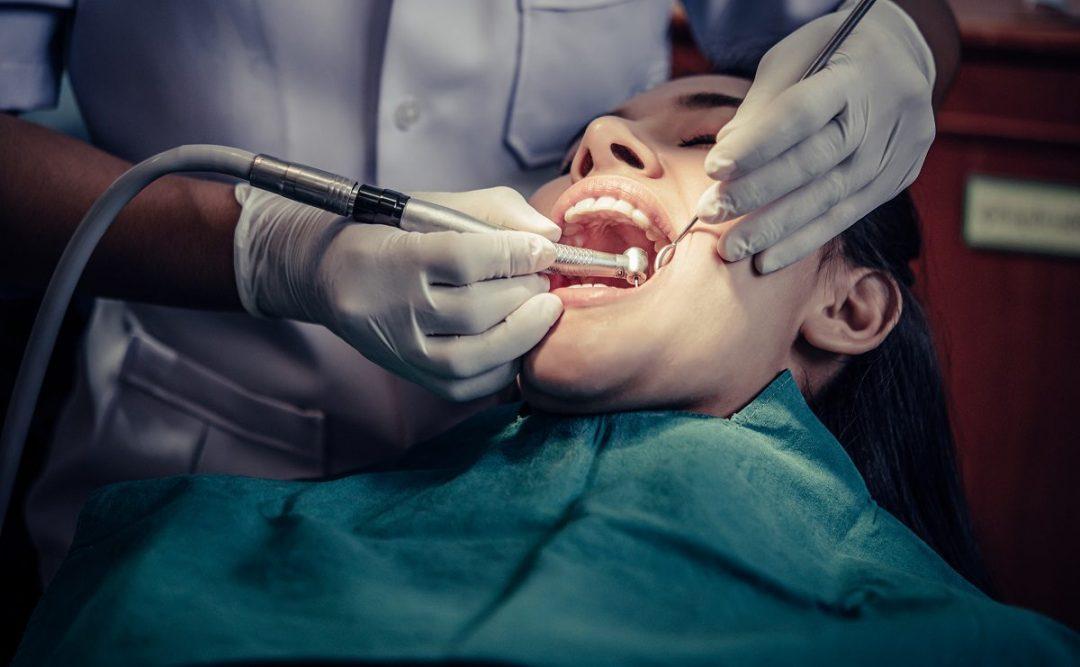 Introducing Dental Sealants